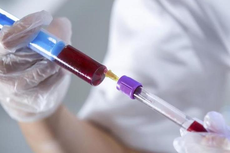 Excess acid in body causes shock, death - Physician warns