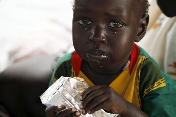 A refugee child from South Sudan feeds on food supplements at a health centre at the Kule refugee camp in Ethiopia's Gambella region, April 1, 2015. . REUTERS/Thomas Mukoya