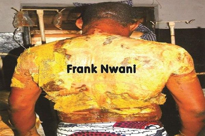 The victim Frank Nwani