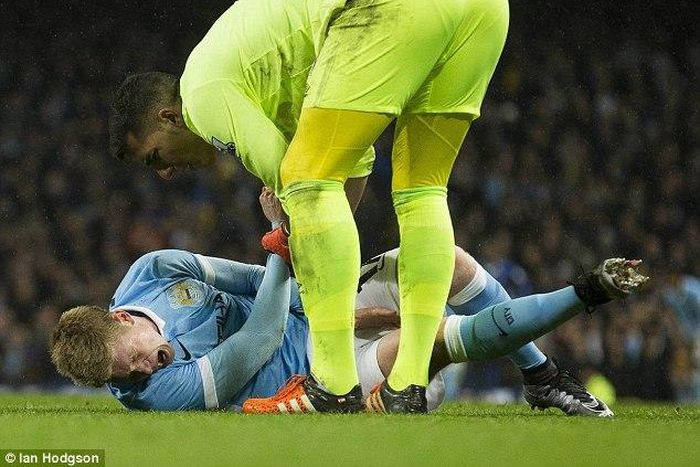 Kevin de Bruyne damaged his ligament in Manchester City's Capital One win over Everton