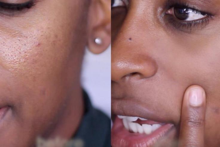Jackie Aina shows a 'before' enlarged and 'after' minimized pores