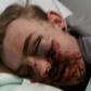 Danny Beardmore after being attacked at night