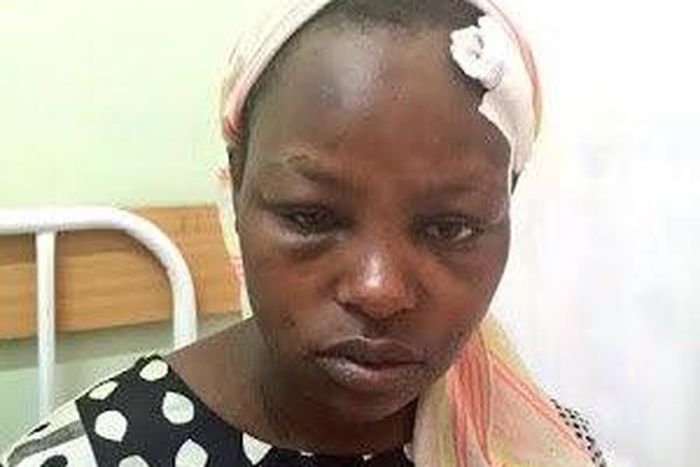6 months pregnant woman brutally assaulted by husband