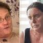 Colombia passes tougher law to tackle high rates of acid attacks
