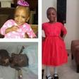 Little girl weighing 650g at birth now 5-yrs-old