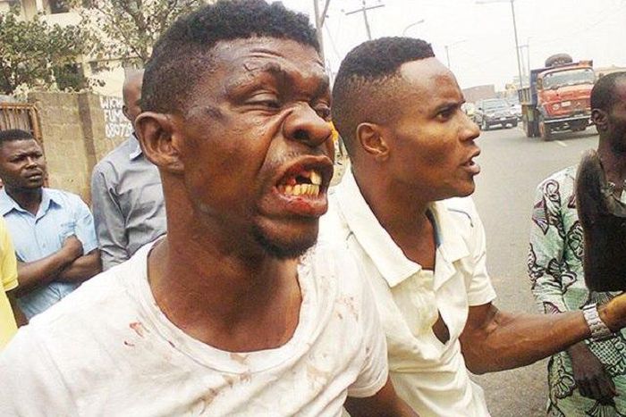 Kingsley, the brutalised driver with his missing teeth