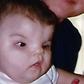 Meet woman born with hole in skull and no Nose