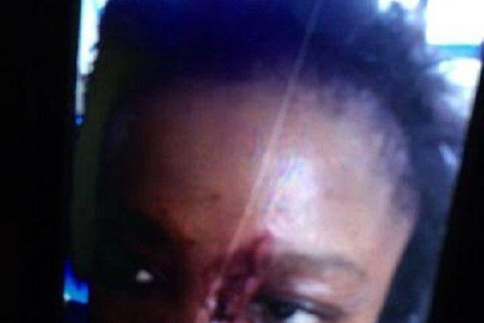 The bloodied face of the woman