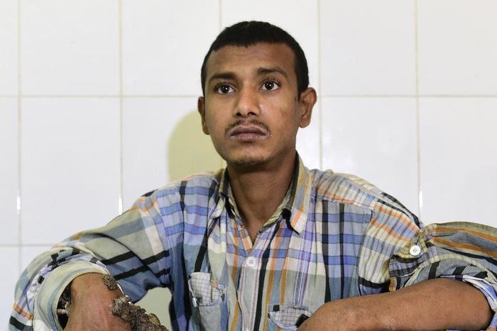 See pictures of Man who has tree roots growing all over his hands