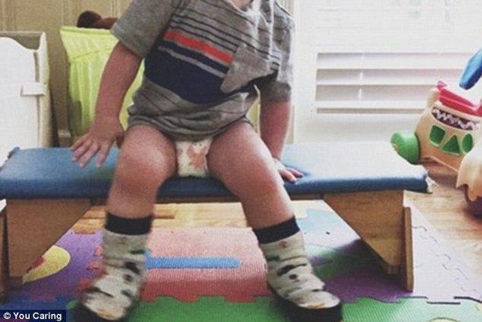 2-year-old boy eats every hour to stop his body eating his own muscles