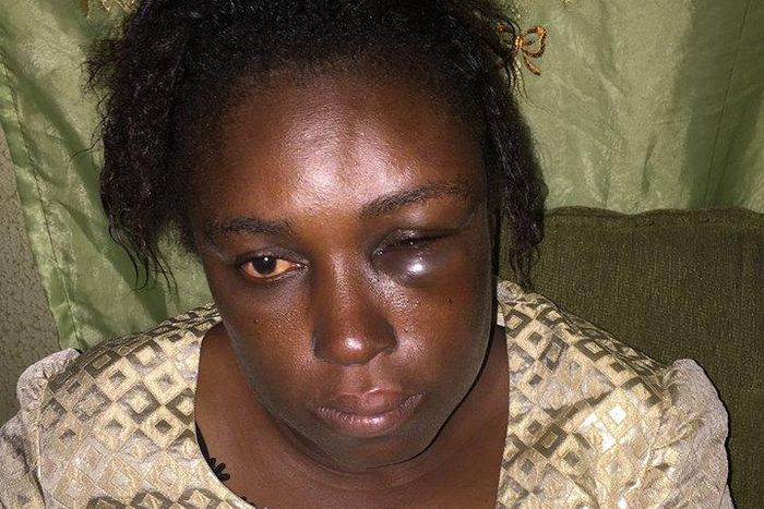 A battered Abiose Comfort