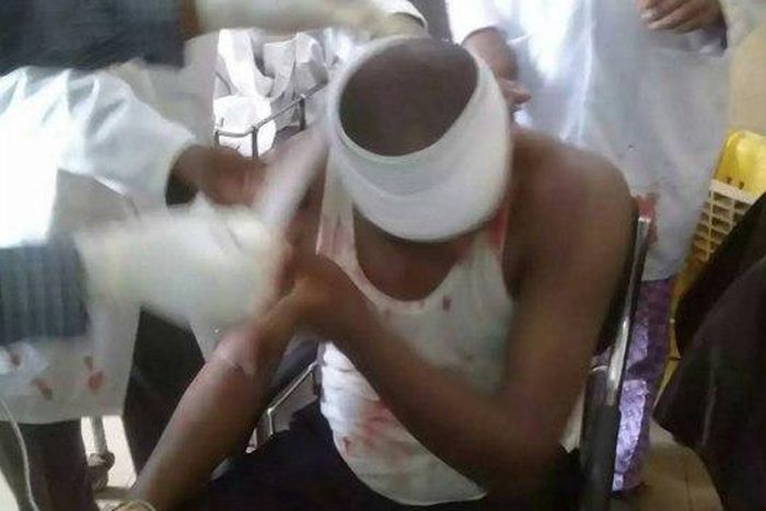 Dr. Bende Azudialo reportedly shot in the head by a police officer during a peaceful protest