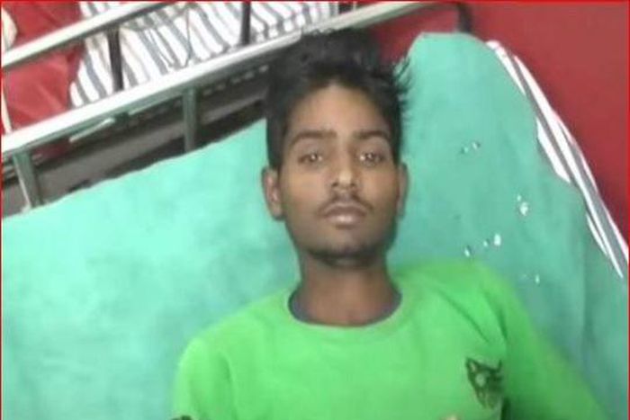 Deformed baby with teeth found in 18-year boy's stomach