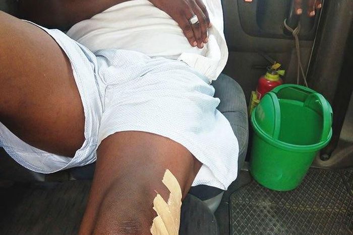 Kazeem Opagun reportedly shot in the leg by Ifeanyi Okpoko, over ex wife's landed property