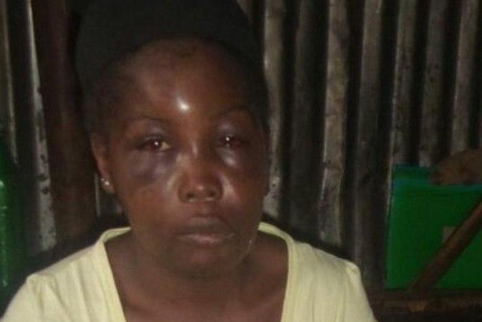 The brutalised Lydia Nyanchama