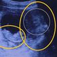 Woman's ultra sound photo goes viral after a 'demon' is spotted watching her baby