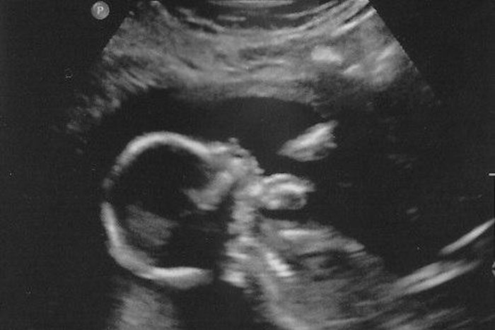 Baby in womb