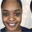 skin blemishes can be perfectly concealed with makeup