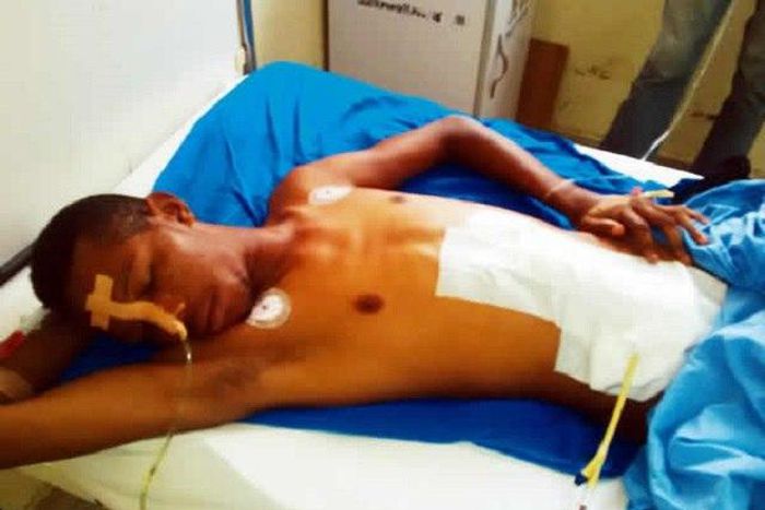 The brutalised John Ekefre