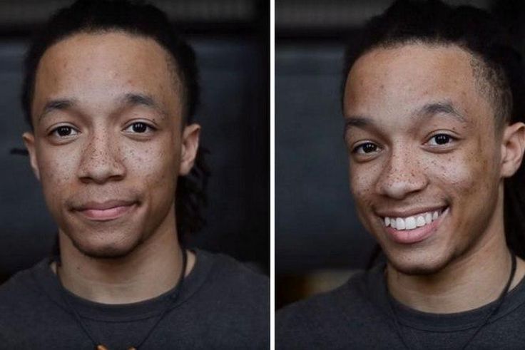 Before and after he was told he is beautiful