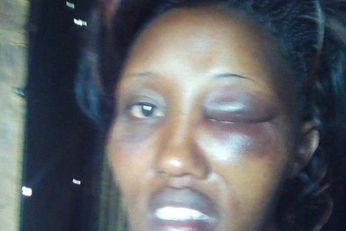 The battered politician, Eunice Leshunet