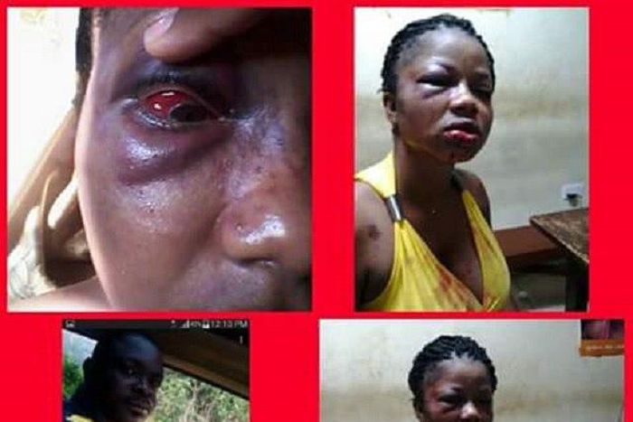 Victim of domestic brutality