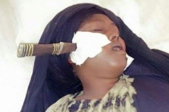 A woman with a damaged face