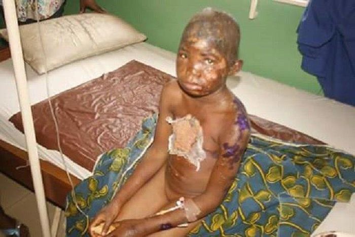 The abused Chinwendu Precious