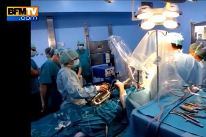 Musician plays saxophone during brain surgery to ensure surgeons do not damage him