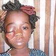 This little Kehinde Oke needs the assistance of Nigerians.