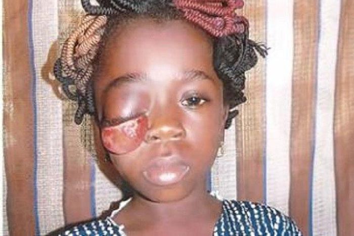 This little Kehinde Oke needs the assistance of Nigerians.