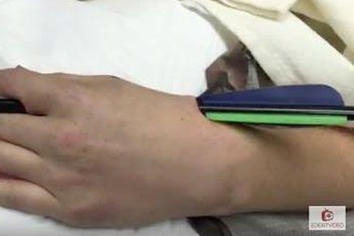 Archer gets accidentally impaled by arrow after he slipped