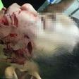 Tran Truong Thinh suffered serious injuries to his face after being bitten by the family's pet dog.