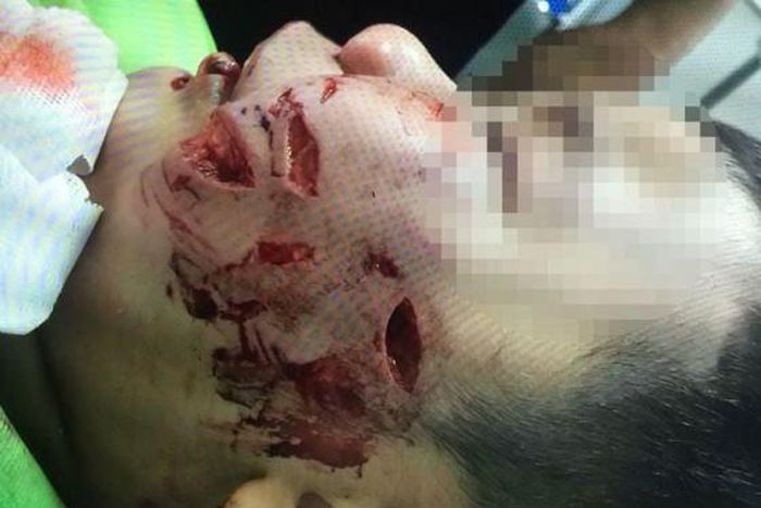 Tran Truong Thinh suffered serious injuries to his face after being bitten by the family's pet dog.