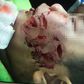 Tran Truong Thinh suffered serious injuries to his face after being bitten by the family's pet dog.