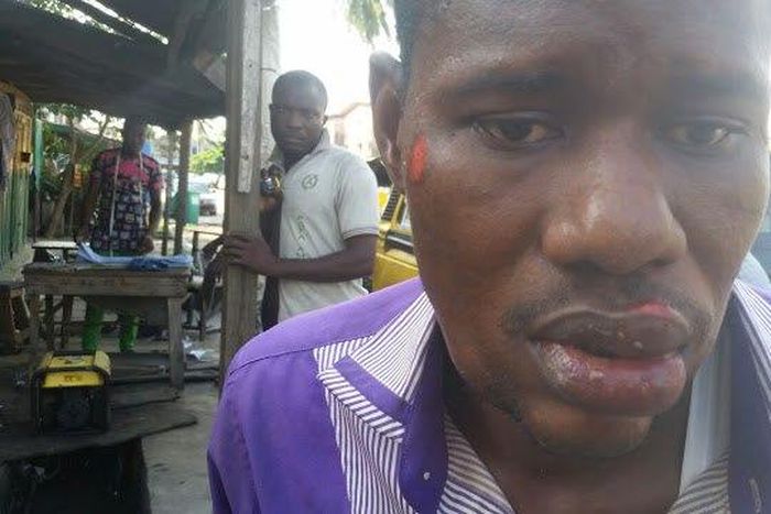 Unidentified man beaten up by LASTMA officials