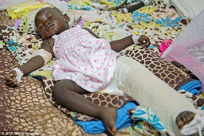 Nyalou Thong survives Sudan plane crash