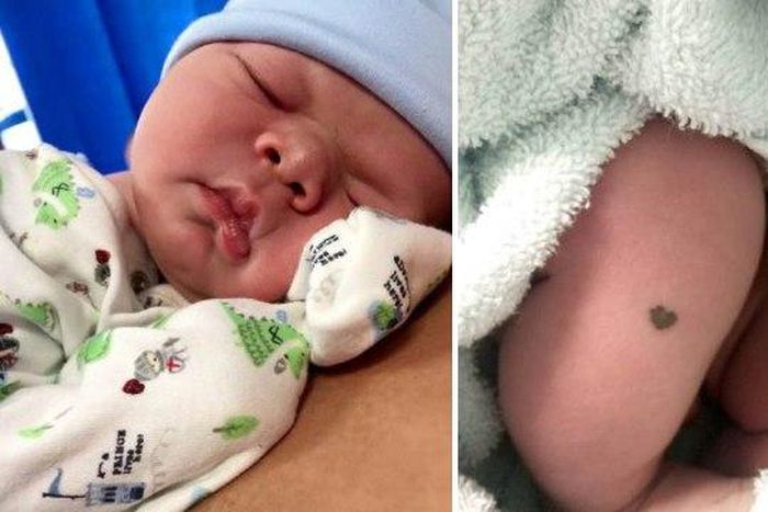 Meet Baby born with adorable heart-shaped smiley on his leg