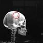 A Chinese woman who has always had regular headaches was surprised to learn that a sharp object was stucked inside her skull.