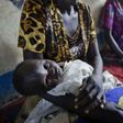 Cholera outbreak kills 18 in south Sudan