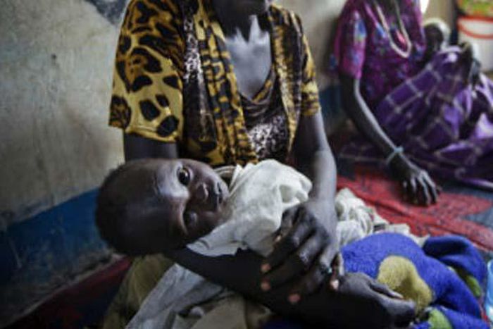 Cholera outbreak kills 18 in south Sudan