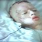 8-yr-old Robbie Middleton in a hospital bed after his attack