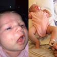 Baby contracts Herpes after getting kissed by family member