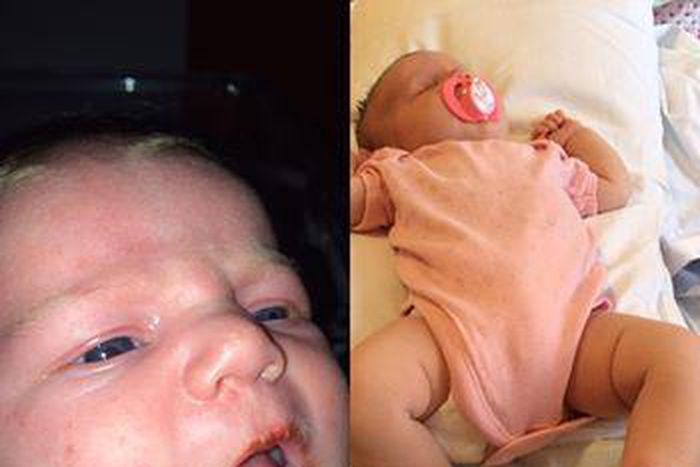 Baby contracts Herpes after getting kissed by family member