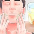 How to get rid of pimples