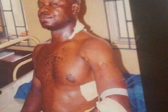 Ehis Ibhaze in the hospital