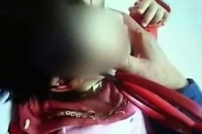 2-year old girl stabs herself in head with scissors