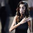 Lizzie Velasquez