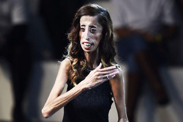 Lizzie Velasquez