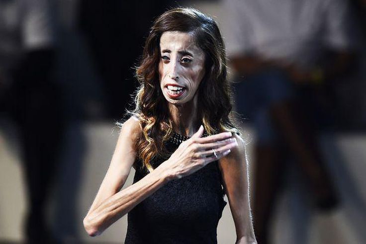 Lizzie Velasquez